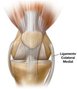 Ligamento Colateral Medial LCM