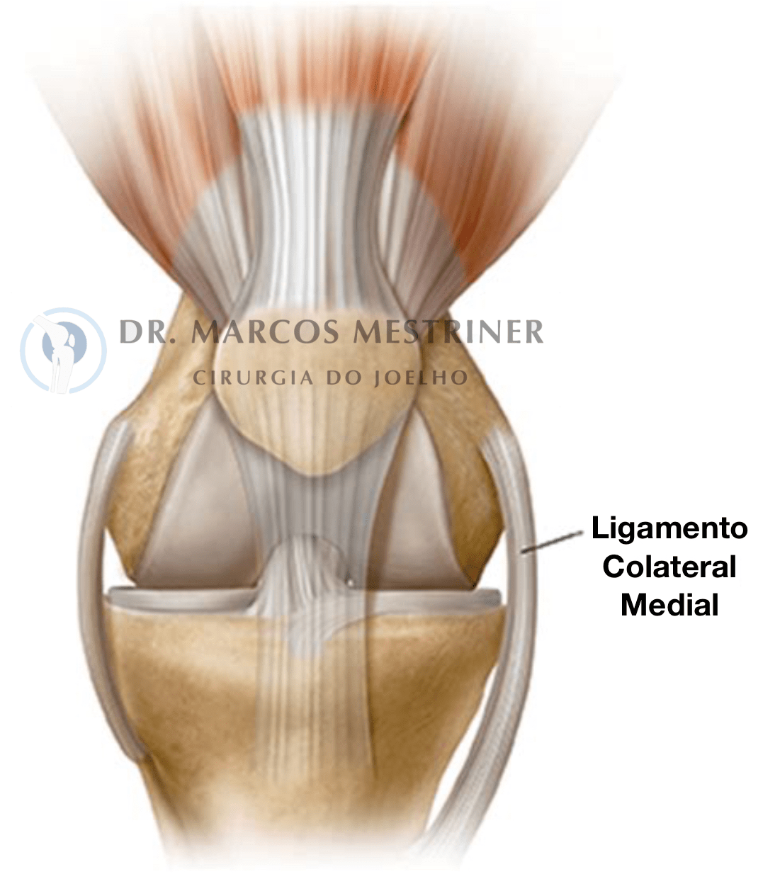 Ligamento Colateral Medial
LCM