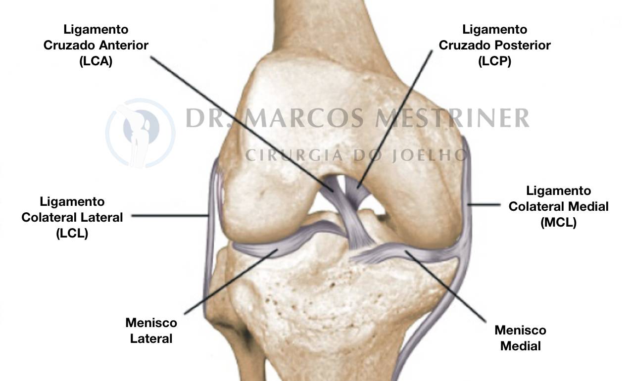 Ligamentos e Meniscos Joelho
Luxação do Joelho