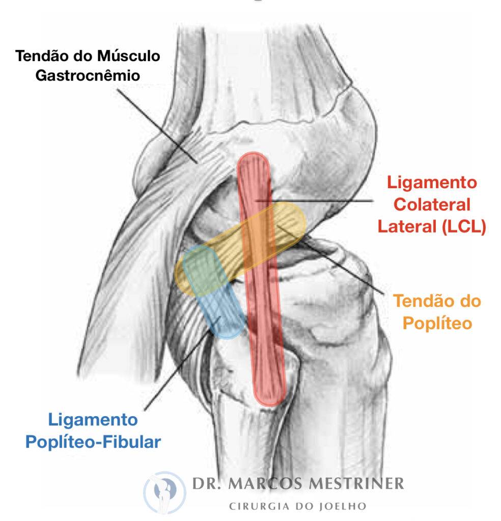 Canto póstero-lateral
Ligamento colateral lateral
Tendão do poplíteo
Ligamento poplíteo-fibular
LCL
CPL